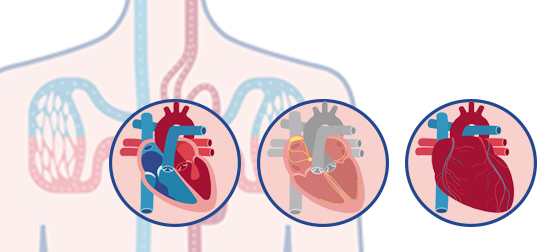 Grafische Darstellung des Herzens. Das Bild linkt auf den Artikel "So arbeitet das Herz."